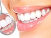 19 szokás, ami tönkreteszi a fogaidat