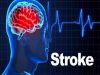 7 dolog, amivel megelőzhető a stroke